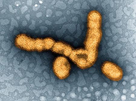 インフルエンザウイルスの電子顕微鏡写真（米国立アレルギー感染症研究所提供）