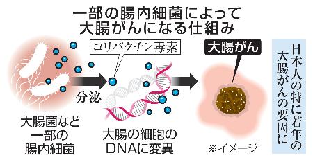 一部の腸内細菌によって大腸がんになる仕組み（イメージ）