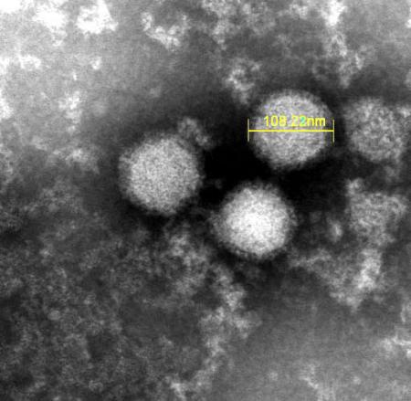 「重症熱性血小板減少症候群」を引き起こすウイルスの電子顕微鏡写真（国立健康危機管理研究機構提供）