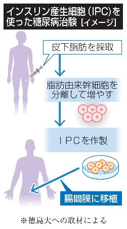 インスリン産生細胞（ＩＰＣ）を使った糖尿病治験（イメージ）