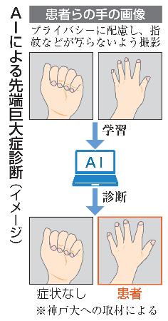 ＡＩによる先端巨大症診断（イメージ）